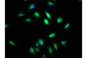 Immunofluorescence staining of A549 cells with ABIN7144797 at 1:133, counter-stained with DAPI. (ATXN7 抗体  (AA 402-503))