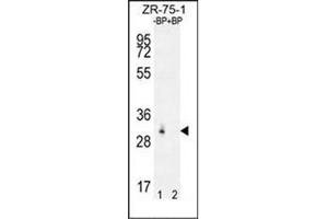 Western blot analysis of RAB40AL Antibdy (N-term) Cat. (RAB40AL 抗体  (N-Term))