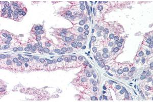 Human Prostate; Immunohistochemistry with Human Prostate lysate tissue at an antibody concentration of 5. (NAB1 抗体  (N-Term))