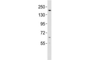 Western blot testing of KDM6B antibody at 1:2000 dilution + mouse lung lysate (Kdm6b 抗体  (AA 879-912))
