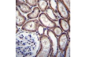 Immunohistochemistry (Paraffin-embedded Sections) (IHC (p)) image for anti-DnaJ (Hsp40) Homolog, Subfamily C, Member 27 (DNAJC27) (AA 1-30), (N-Term) antibody (ABIN951949)