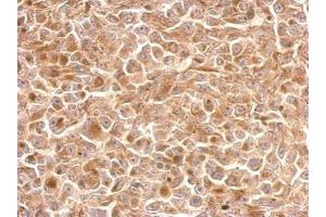 Immunohistochemistry (IHC) image for anti-Killer Cell Lectin-Like Receptor Subfamily C, Member 1 (KLRC1) (N-Term) antibody (ABIN2856611)