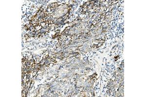 IHC analysis of Thioredoxin 2/TXN2 using anti-Thioredoxin 2/TXN2 antibody (ABIN7602148).