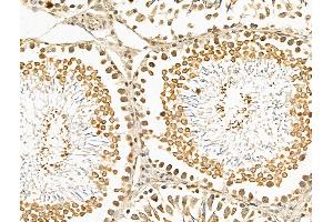 ABIN7094737 and ABIN7098788 at 1/100 staining Rat testis tissue by IHC-P. (TEAD2 抗体  (Internal Region))