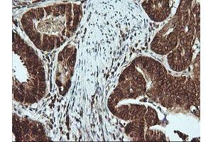 Image no. 1 for anti-Musashi Homolog 2 (MSI2) antibody (ABIN1499578) (MSI2 抗体)