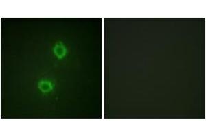 Immunofluorescence analysis of HuvEc cells, using FGFR1 (Ab-654) Antibody. (FGFR1 抗体  (AA 626-675))