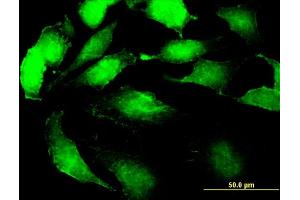 Immunofluorescence (IF) image for anti-Signal Sequence Receptor, beta (Translocon-Associated Protein Beta) (SSR2) (AA 51-150) antibody (ABIN520506)
