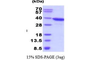 AKR1C3 Protein (AA 1-323)