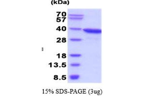 AKR1C3 Protein (AA 1-323)