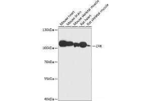 Western blot analysis of extracts of various cell lines using ZAK Polyclonal Antibody at dilution of 1:3000. (ZAK 抗体)