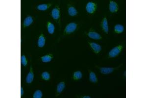 IF analysis of SDHA using anti-SDHA antibody (ABIN3043324).