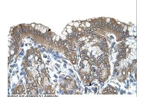 RARRES3 antibody was used for immunohistochemistry at a concentration of 4-8 ug/ml. (RARRES3 抗体)
