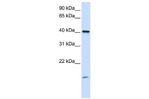 Western Blotting (WB) image for anti-Transmembrane Protein 79 (TMEM79) antibody (ABIN2459356) (TMEM79 抗体)