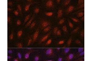 Immunofluorescence analysis of U2OS cells using CETN3 Polyclonal Antibody at dilution of 1:100. (CETN3 抗体)