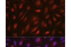 Immunofluorescence analysis of U2OS cells using CETN3 Polyclonal Antibody at dilution of 1:100. (CETN3 抗体)