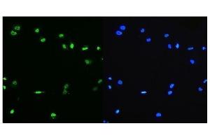 IF analysis of PTBP1 using anti-PTBP1 antibody (ABIN7599450).