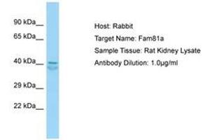 Image no. 1 for anti-Family with Sequence Similarity 81, Member A (FAM81A) (AA 143-192) antibody (ABIN6749924) (FAM81A 抗体  (AA 143-192))