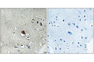 Immunohistochemistry analysis of paraffin-embedded human brain tissue, using DVL3 Antibody. (DVL3 抗体  (AA 326-375))