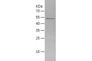 SMAD5 Protein (AA 186-465) (His-IF2DI Tag)