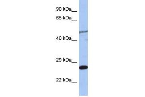 MIS12 antibody used at 1 ug/ml to detect target protein. (MIS12 抗体)