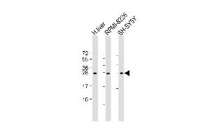 Western Blot at 1:2000 dilution Lane 1: human liver lysate Lane 2: RPMI-8226 whole cell lysate Lane 3: SH-SY5Y lysate Lysates/proteins at 20 ug per lane. (NT5M 抗体  (AA 195-226))