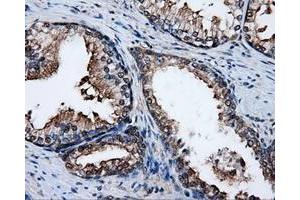 Immunohistochemical staining of paraffin-embedded liver tissue using anti-PSMC3mouse monoclonal antibody. (PSMC3 抗体)