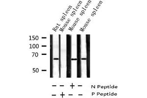 Western blot analysis of Phospho-ZAP-70 (Tyr319) expression in various lysates (ZAP70 抗体  (pTyr319))