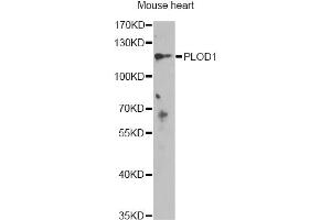 Western blot analysis of extracts of mouse heart, using PLOD1 antibody (ABIN6289945) at 1:1000 dilution. (PLOD1 抗体)