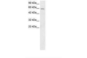Image no. 3 for anti-Forkhead Box G1 (FOXG1) (AA 139-169) antibody (ABIN202606) (FOXG1 抗体  (AA 139-169))