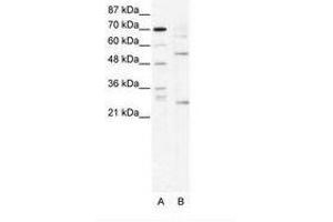 Image no. 1 for anti-T-Cell Acute Lymphocytic Leukemia 1 (TAL1) (AA 236-285) antibody (ABIN202266) (TAL1 抗体  (AA 236-285))