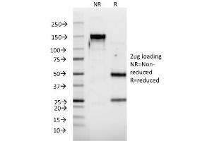 SDS-PAGE Analysis Purified IFNA2 Mouse Monoclonal Antibody (N39). (IFNA2 抗体)