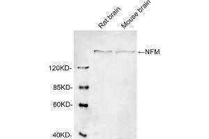 Western blot analysis of cell lysates using 1 µg/mL Rabbit Anti-Neurofilament-M Polyclonal Antibody (ABIN398865) The signal was developed with IRDyeTM 800 Conjugated Goat Anti-Rabbit IgG. (NEFM 抗体  (AA 320-370))