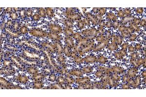 Detection of TXNRD1 in Mouse Kidney Tissue using Polyclonal Antibody to Thioredoxin Reductase 1 (TXNRD1)