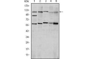 Western blot analysis using HIF1A mouse mAb against Cos7 (1), Hela (2), Jurkat (3), RAJI (4) and NIH/3T3 (5) cell lysate. (HIF1A 抗体)