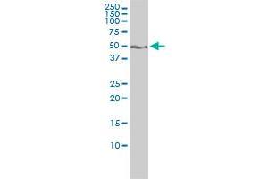 Western Blotting (WB) image for anti-Zinc Finger Protein 277 (ZNF277) (AA 1-278) antibody (ABIN564856)