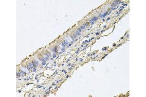 Immunohistochemistry of paraffin-embedded Human trachea using EPOR Polyclonal Antibody at dilution of 1:100 (40x lens). (EPOR 抗体)