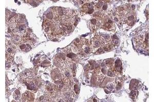 ABIN6267593 at 1/100 staining human liver tissue sections by IHC-P. (MEK1 抗体  (pSer217))