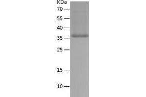 Western Blotting (WB) image for Zinc Finger, FYVE Domain Containing 27 (ZFYVE27) (AA 209-349) protein (His-IF2DI Tag) (ABIN7283754) (ZFYVE27 Protein (AA 209-349) (His-IF2DI Tag))