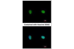 ICC/IF Image Immunofluorescence analysis of paraformaldehyde-fixed HeLa, using Ku70, antibody at 1:500 dilution. (XRCC6 抗体)