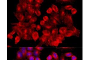 Immunofluorescence analysis of HeLa cells using CLTC Polyclonal Antibody at dilution of 1:100 (40x lens). (Clathrin Heavy Chain (CLTC) 抗体)