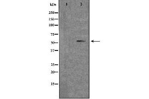 Western blot analysis of extracts from COLO cells, using OPN4 antibody. (OPN4 抗体  (C-Term))