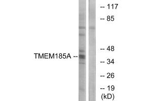 Western blot analysis of extracts from K562 cells, using TMEM185A antibody. (TMEM185A 抗体  (C-Term))