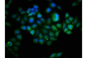 Immunofluorescence staining of Hela cells with ABIN7145166 at 1:133, counter-stained with DAPI.