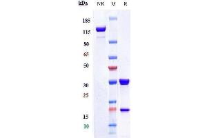 Anti-CEACAM5 / CEA / CD66e Reference Antibody (tusamitamab) on SDS-PAGE under reducing (R) condition. (Recombinant CEACAM5 (Tusamitamab Biosimilar) 抗体)