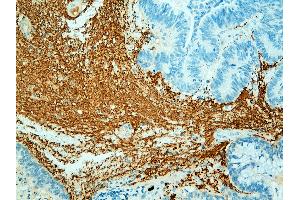 Immunohistochemistry (IHC) image for anti-Neurofilament 150, 200kD antibody (ABIN108435) (Neurofilament 150, 200kD 抗体)
