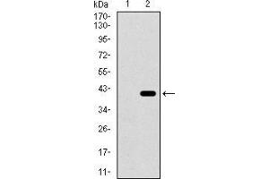 Western blot analysis using ITGA2B mAb against HEK293 (1) and ITGA2B (AA: 45-149)-hIgGFc transfected HEK293 (2) cell lysate. (Integrin Alpha2b 抗体  (AA 45-149))