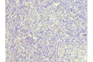 Immunohistochemistry of paraffin-embedded human thymus tissue using ABIN7147523 at dilution of 1:100 (CHMP2B 抗体  (AA 1-213))