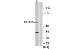 Western blot analysis of extracts from Jurkat cells, using T3JAM Antibody. (TRAF3IP3 抗体  (AA 251-300))