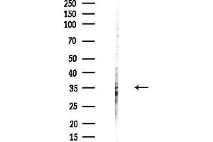 Western blot analysis of lysates from HUVEC cells(starvation,24h treatment), using PRKRA Antibody at 1/1000 dilution.