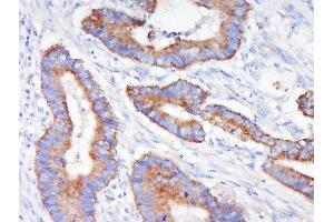 Immunohistochemistry (Paraffin-embedded Sections) (IHC (p)) image for anti-Mitogen-Activated Protein Kinase Kinase 1 (MAP2K1) (AA 2-150) antibody (ABIN686482)